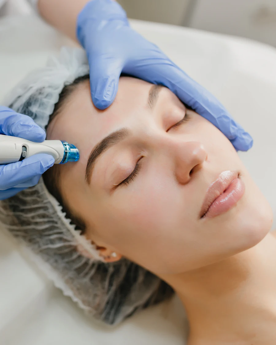 Profissional aplicando peeling no rosto de uma cliente